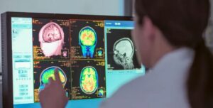 La adolescencia dura hasta los 32 años, según un nuevo estudio